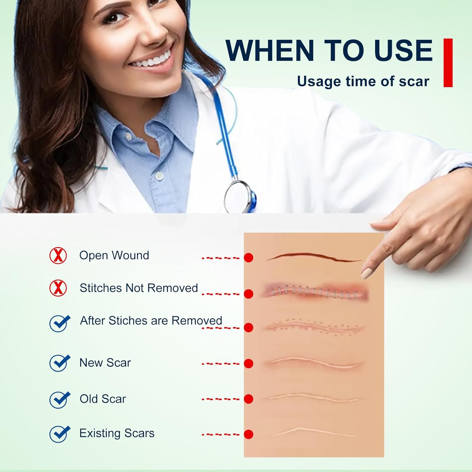 Silicone Scar Sheet Roll